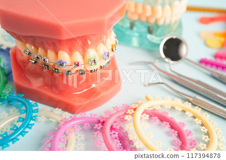 Orthodontic ligatures rings and ties, elastic rubber bands on orthodontic braces, model for dentist studying about dentistry. 117394878