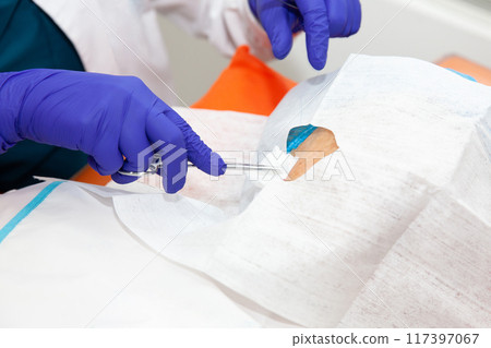 Dermatologist carrying out a skin biopsy on the face of a senior adult patient 117397067