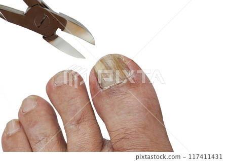 剪腳趾甲 剪腳趾甲 117411431