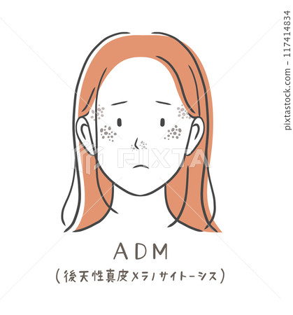 Illustration material of a woman suffering from age spots (ADM) 117414834