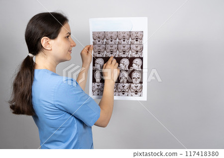 The doctor holds an MRI image of the pituitary gland of a healthy person. The doctor holds an MRI image of the pituitary gland of a healthy person. 117418380