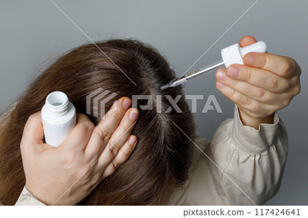 Balding woman with serum peptide or minoxidil close-up. Hair loss and alopecia concept. Balding woman with serum peptide or minoxidil close-up. Hair loss and alopecia concept. 117424641