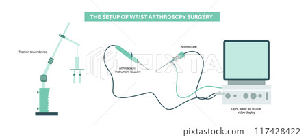 Wrist arthroscopy surgery 117428422