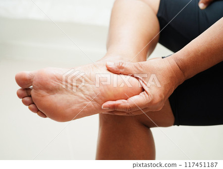 Asian woman check feet with crack and dry heel skin, Diabetic Foot. Asian woman check feet with crack and dry heel skin, Diabetic Foot. 117451187