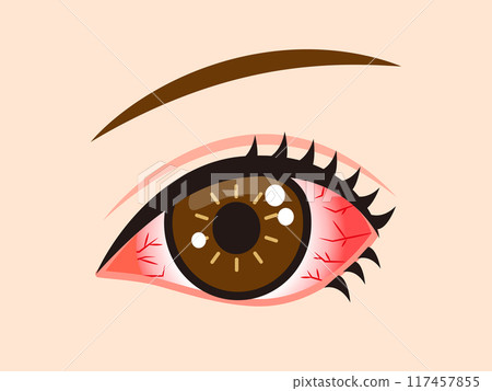 Illustration material of bloodshot red eyes 117457855