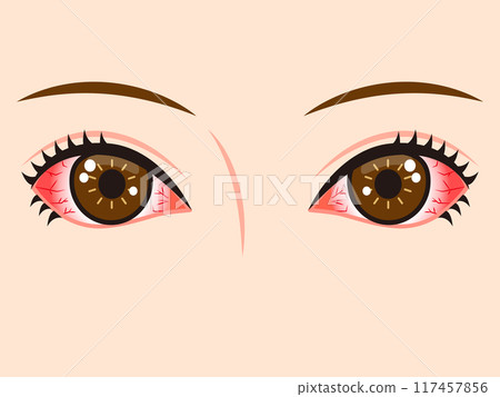 Illustration material of bloodshot red eyes 117457856