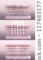 Skin before and after laser collagen-boosting therapy. Stylized wrinkled and tightened skin layer 3D render 117483577