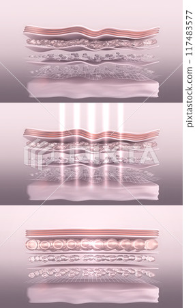 Skin before and after laser collagen-boosting therapy. Stylized wrinkled and tightened skin layer 3D render 117483577