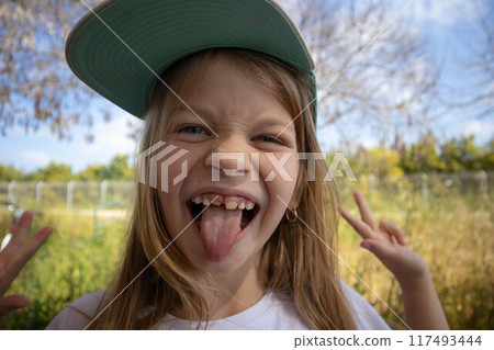 The little girl smiles. Permanent teeth appeared. 117493444