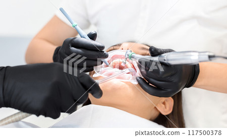 Close up of young woman attending dentist doctor, getting modern treatment 117500378