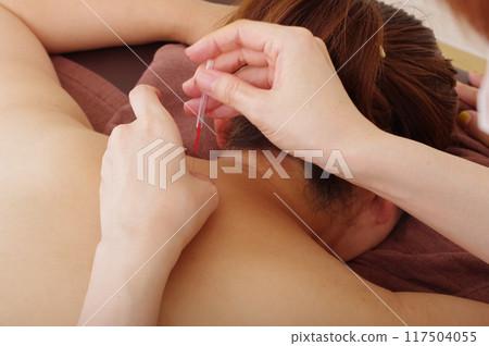 一名婦女在針灸診所接受背部針灸治療 一名婦女在針灸診所接受背部針灸治療 117504055