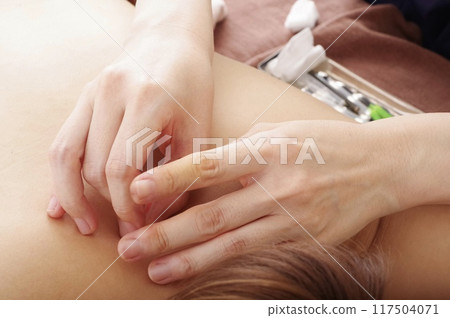 一名婦女在針灸診所接受背部針灸治療 一名婦女在針灸診所接受背部針灸治療 117504071