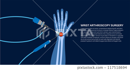 Wrist arthroscopy surgery Wrist arthroscopy surgery 117518694