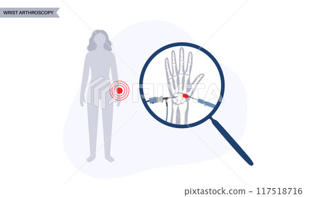 Wrist arthroscopy surgery Wrist arthroscopy surgery 117518716