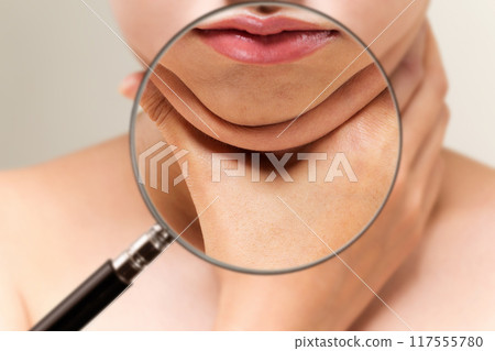 A magnifying glass zooms in on a woman's double chin. A magnifying glass zooms in on a woman's double chin. 117555780