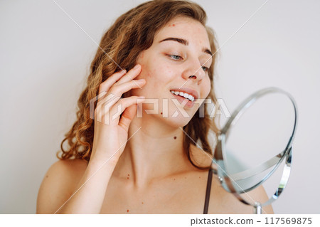 Close-up of a cute woman with problem skin looking in the mirror. Dermatology concept, allergy. 117569875