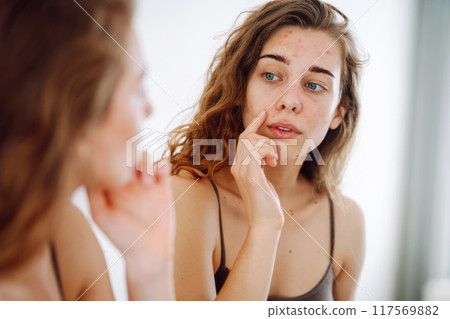 Young woman looks in mirror examining inflammation on her face. Acne skin. Medicine and cosmetology. 117569882