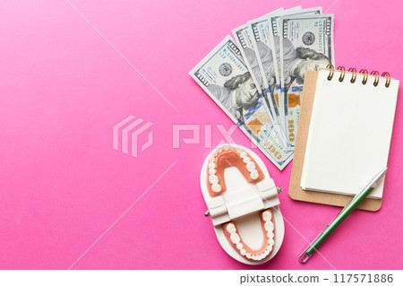Flat lay composition with educational dental typodont model and money with notebook on colored table, top view. Expensive treatment 117571886