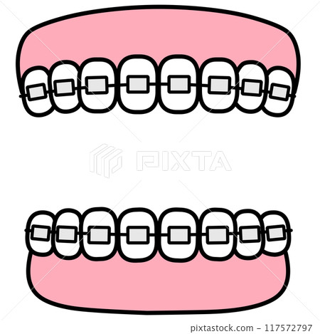 Orthodontics: Teeth and gum frame material 117572797