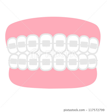 Orthodontics: Illustration of a simple dental model 117572799