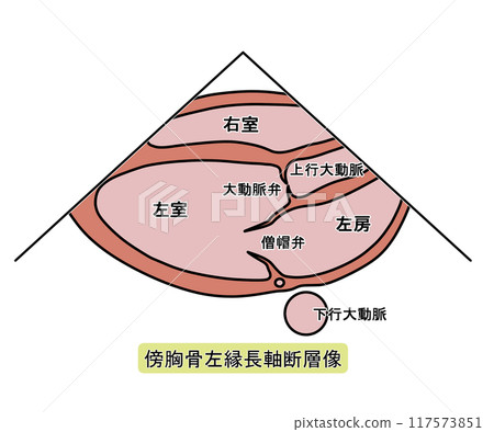 Echocardiogram of the left parasternal border long axis (with text) 117573851