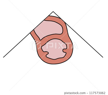 胸骨旁左緣短軸斷層掃描乳頭肌水平（無文字） 117573862