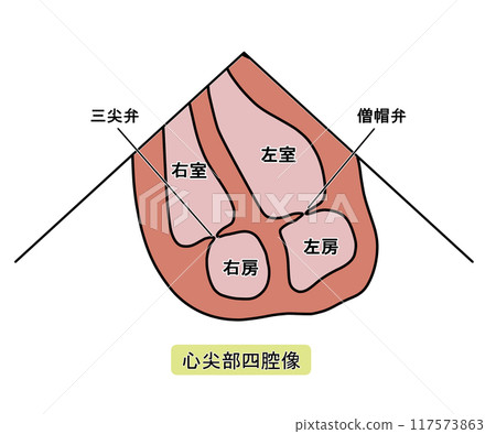 超音波心動圖心尖四腔切面（附文字） 117573863