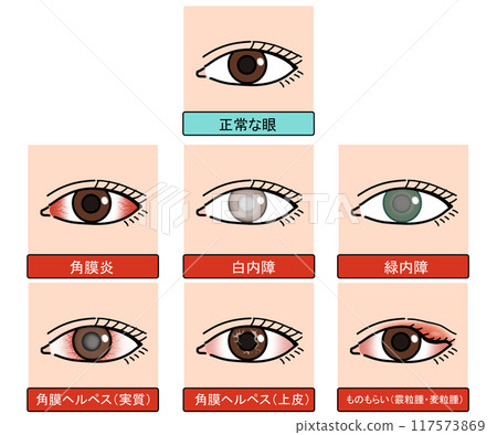 Eye diseases (with text) Eye diseases (with text) 117573869