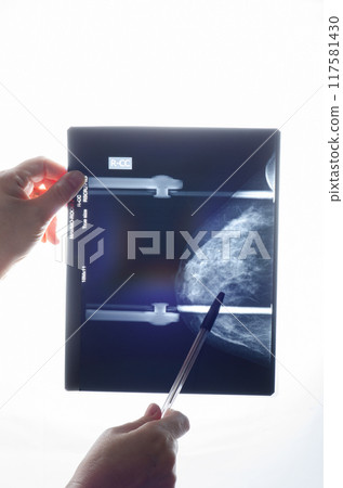 The Art of Interpretation: Medical Professionals Unlock Vital Clues in Mammogram Analysis, Advancing Breast Health Care. The Art of Interpretation: Medical Professionals Unlock Vital Clues in Mammogram Analysis, Advancing Breast Health Care. 117581430