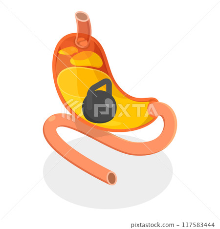 3D Isometric Flat Vector Set of Stomach Problems, Digestive System Issues. Item 2 117583444