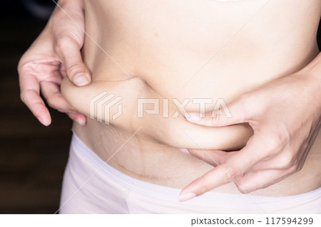 Woman body fat belly, Obese woman hand holding excessive belly fat, Woman using pinch test as one of the methods for measuring body fat on belly, Reduce belly and shape up healthy stomach muscle. Woman body fat belly, Obese woman hand holding excessive belly fat, Woman using pinch test as one of the methods for measuring body fat on belly, Reduce belly and shape up healthy stomach muscle. 117594299