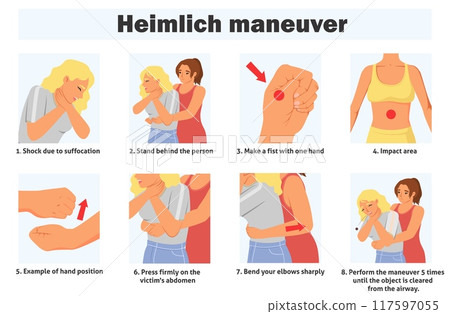 Heimlich maneuver infographic poster with steps of first aid 117597055