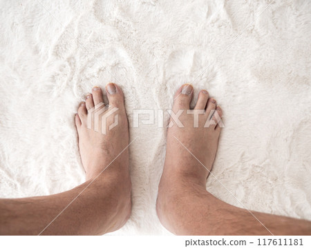 Male foot with long ugly nails Male foot with long ugly nails 117611181