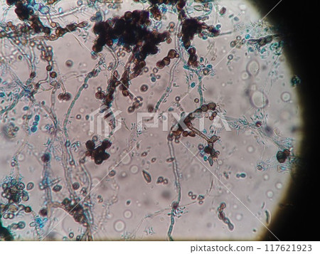 Black mold spores Black mold spores 117621923