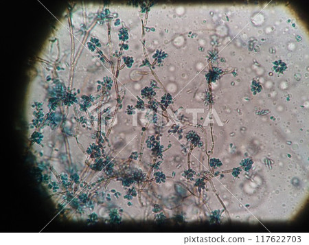 Mold growing around the refrigerator Mold growing around the refrigerator 117622703