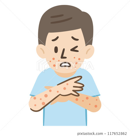一名感染 Empox 的男子的插圖 117652862