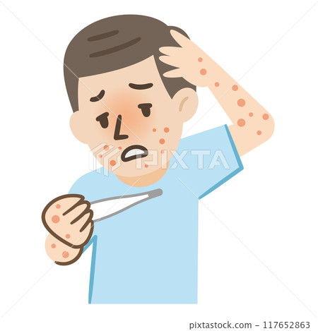 一名男子感染 Empox 發燒的插圖 117652863