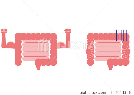 Healthy and unhealthy intestines Healthy and unhealthy intestines 117653366