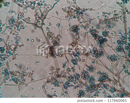 Micrograph of black mold 117660065