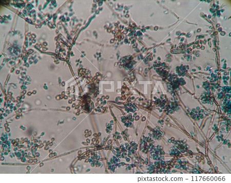 Microscopic photo of black mold spores 117660066