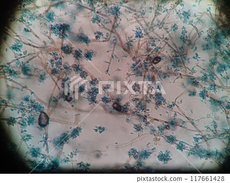 Microscopic image of mold spores spreading out like tiny petals Microscopic image of mold spores spreading out like tiny petals 117661428