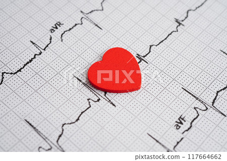 Electrocardiogram (ECG), heart wave, heart attack, cardiogram report. 117664662