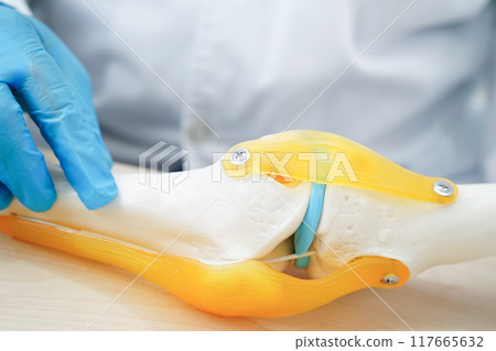 Asian doctor holding spinal nerve and bone model, Lumbar spine displaced herniated disc fragment for treatment medical in the orthopedic department. Asian doctor holding spinal nerve and bone model, Lumbar spine displaced herniated disc fragment for treatment medical in the orthopedic department. 117665632