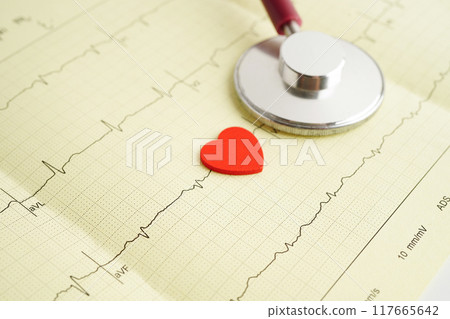 Stethoscope on electrocardiogram (ECG), heart wave, heart attack, cardiogram report. Stethoscope on electrocardiogram (ECG), heart wave, heart attack, cardiogram report. 117665642