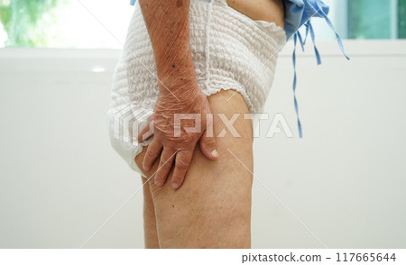 Asian senior woman patient wearing adult incontinence diaper pad in hospital. 117665644