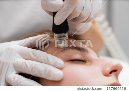 Microdermabrasion treatment session at a skincare clinic for facial rejuvenation 117669636