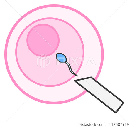 Illustration of artificial insemination for infertility treatment 117687569