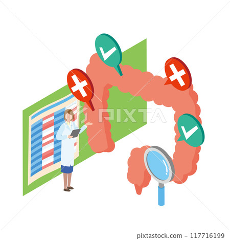 Illustration of a colon examination 117716199