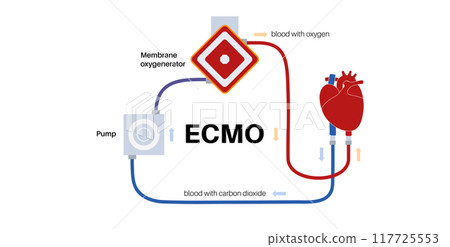 Extracorporeal membrane oxygenation Extracorporeal membrane oxygenation 117725553