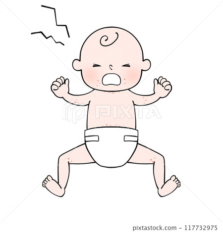 Rash - Illustration of a baby wearing a diaper 117732975